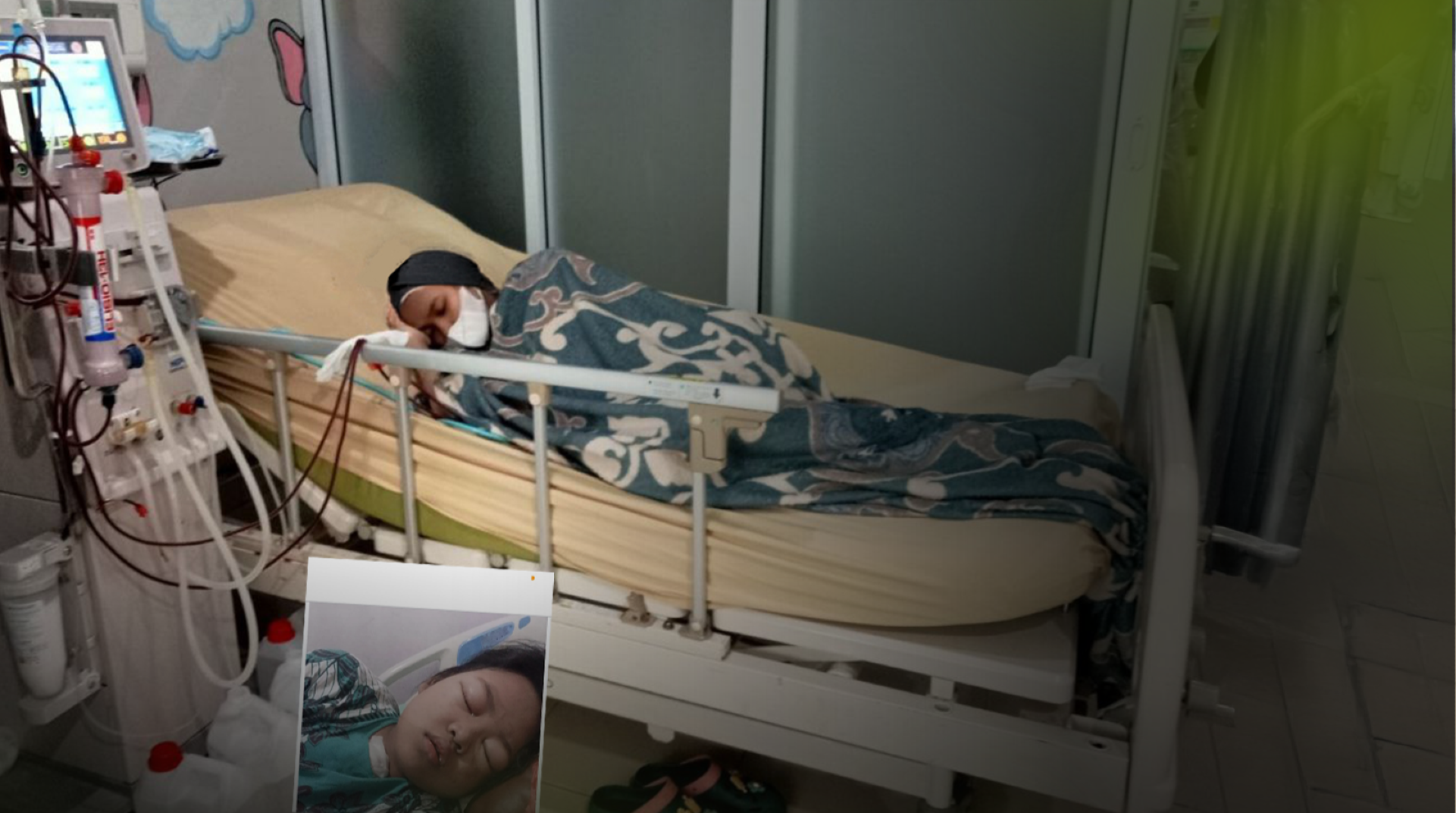 Mengidap Lupus dan Peradangan Ginjal, Pejuang Kecil Butuh Bantuan Segera