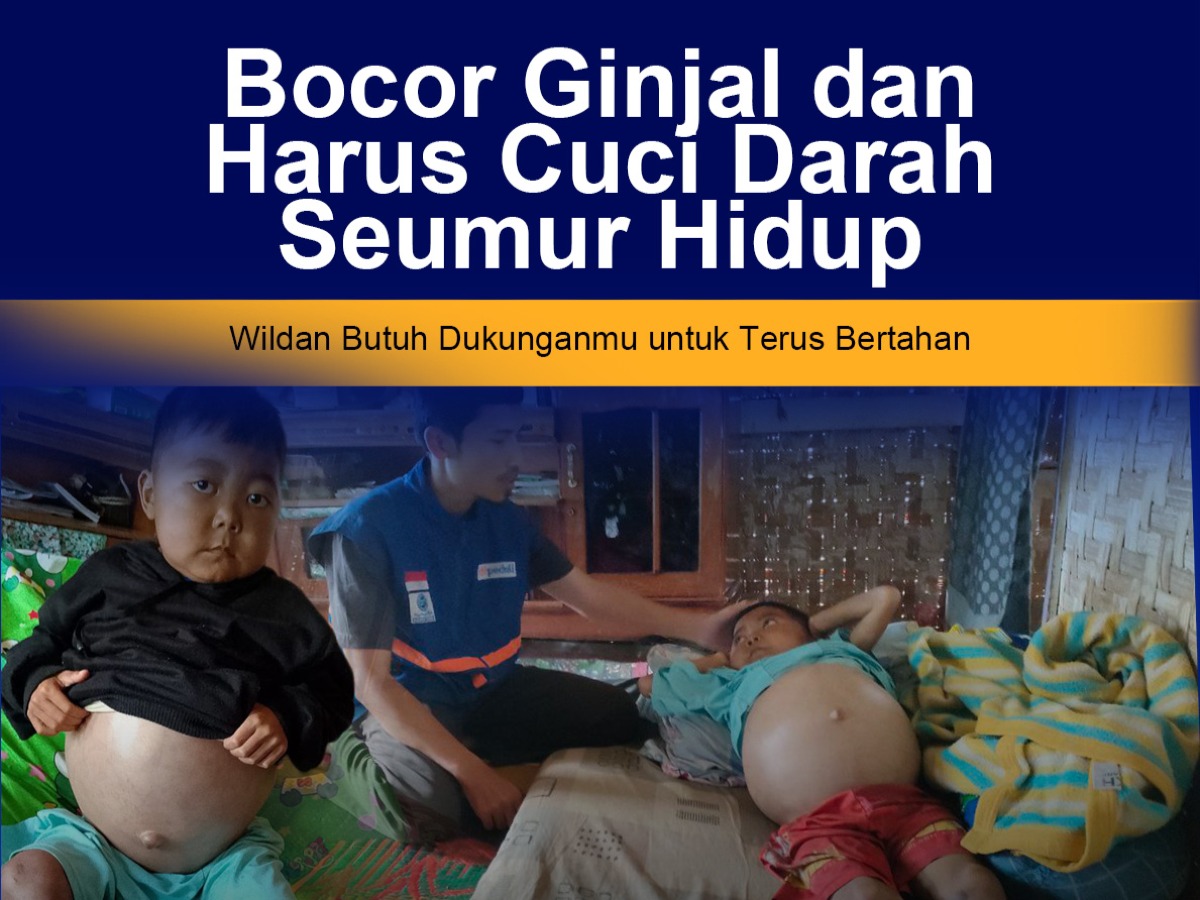 Bocor Ginjal dan Harus Cuci Darah Seumur Hidup, Wildan Butuh Dukunganmu untuk Terus Bertahan