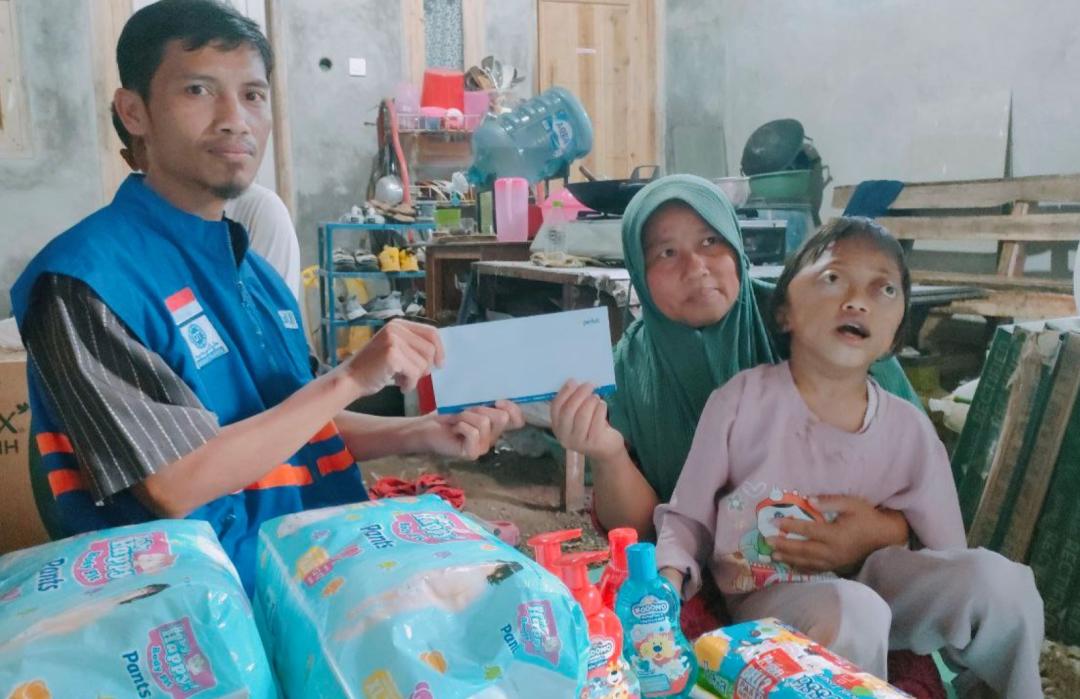 Donatur Berbagi, DT Peduli Salurkan Bantuan Crowdfunding untuk Alika Penderita Sindrom Crouzon 