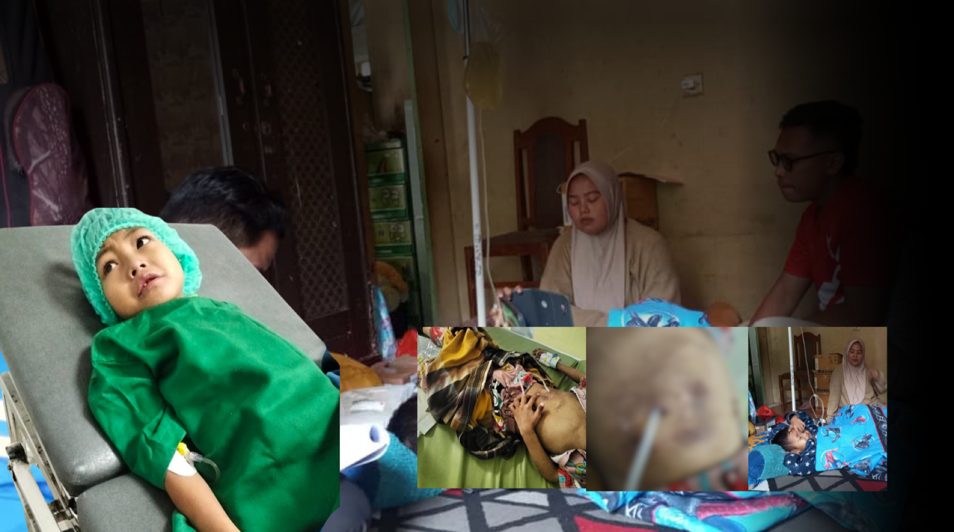 Selamatkan Masa Kecil Salwu dari Gagal Ginjal Kronis, Bantuanmu sangat Berarti