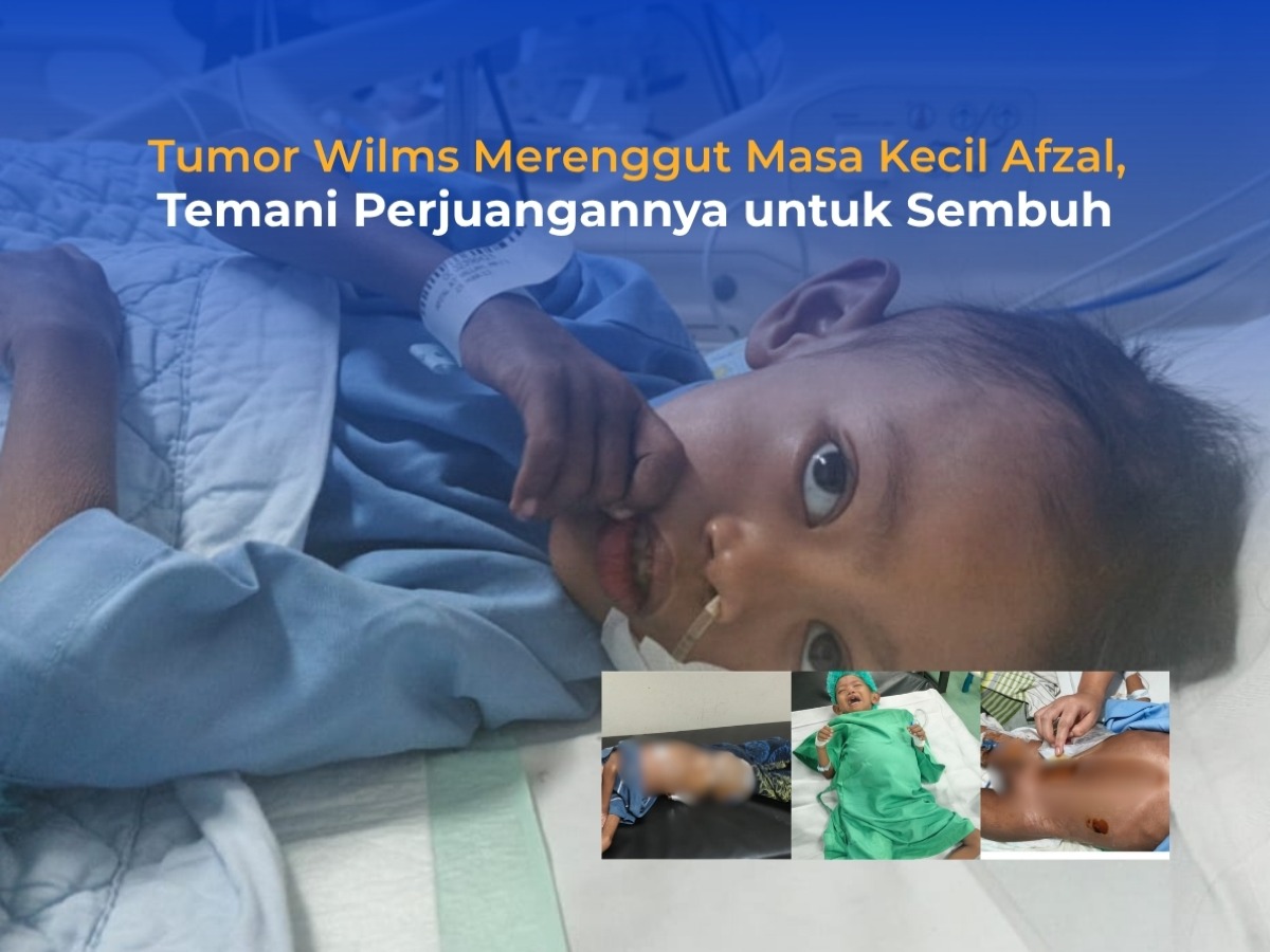 Tumor Wilms Merenggut Masa Kecil Afzal, Temani Perjuangannya untuk Sembuh