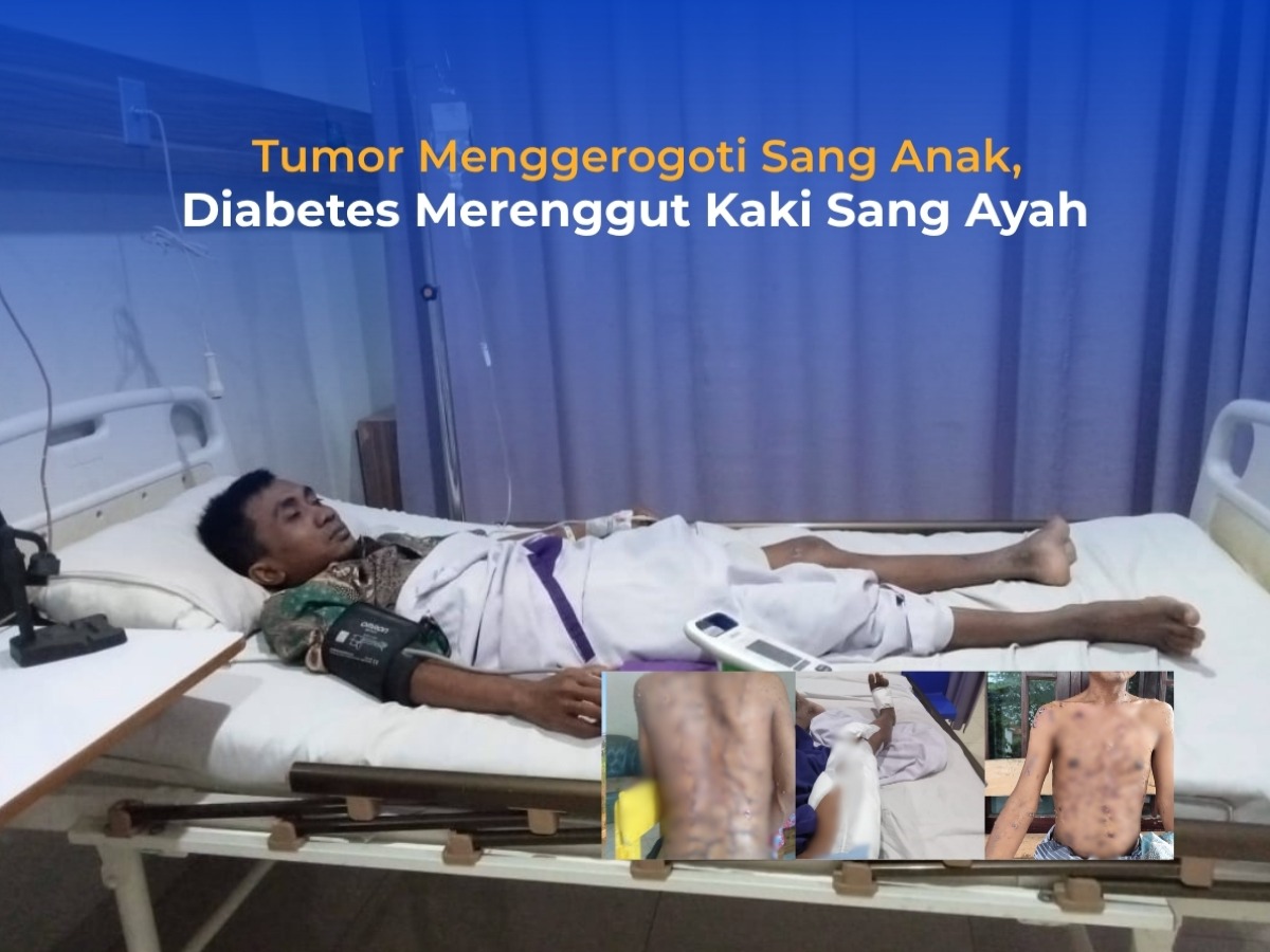 Tumor Menggerogoti Sang Anak, Diabetes Merenggut Kaki Sang Ayah