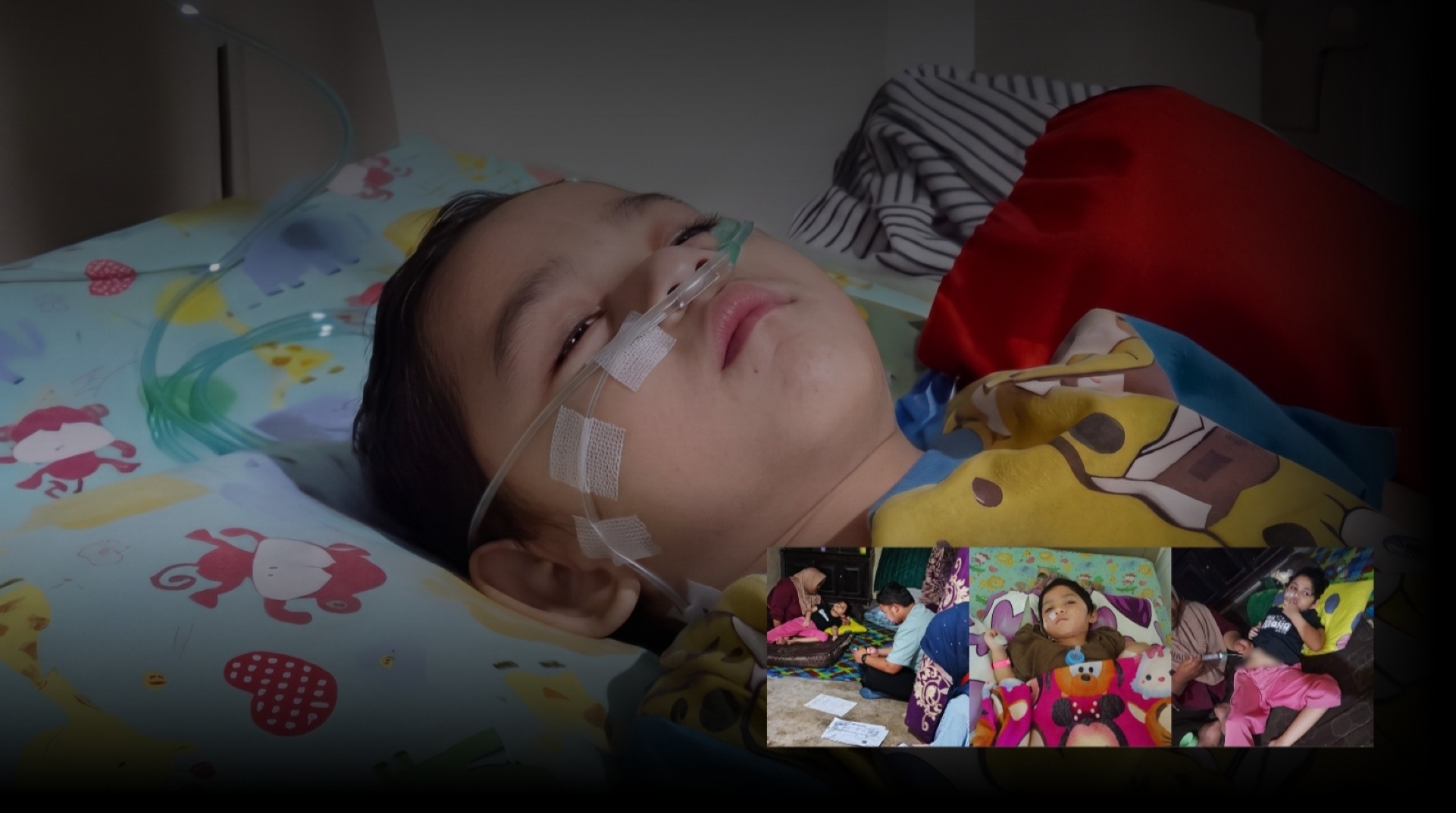 7 Tahun Berjuang Melawan Epilepsi dan Komplikasi, Bantu Salwa Bertahan